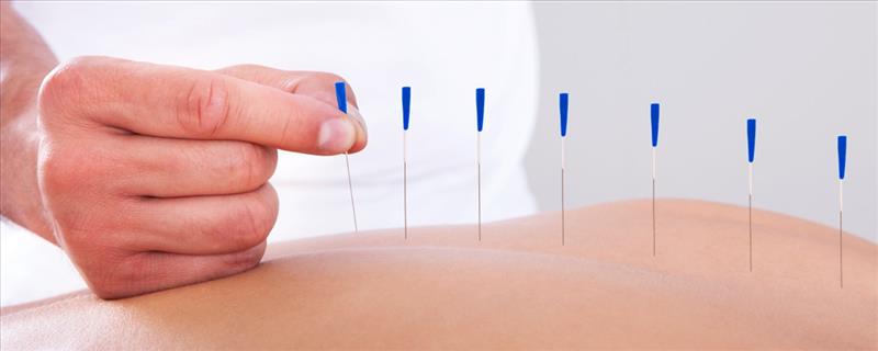 Acupuncture + Stimulation + Doctor Consultation (1 sitting)