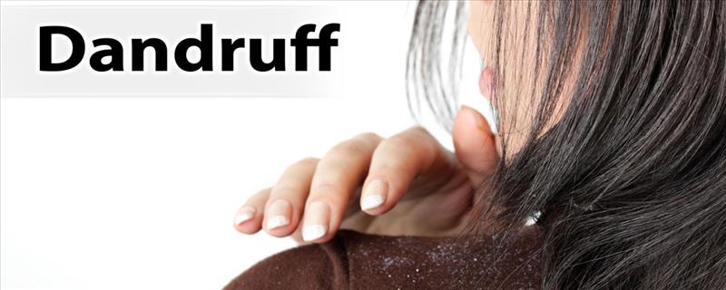 Dandruff Treatment + Veg Peel + Henna + Threading